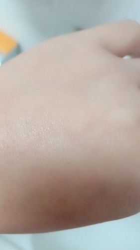 蘭亭玻尿酸原液好用嗎安全嗎，真實(shí)使用體驗(補水/保濕/安全)